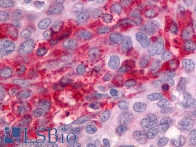 IHC-plus™ ADGRG1 / GPR56 Antibody (Cytoplasmic Domain)