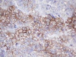 MAGEB18 Antibody (clone OTI1H2)