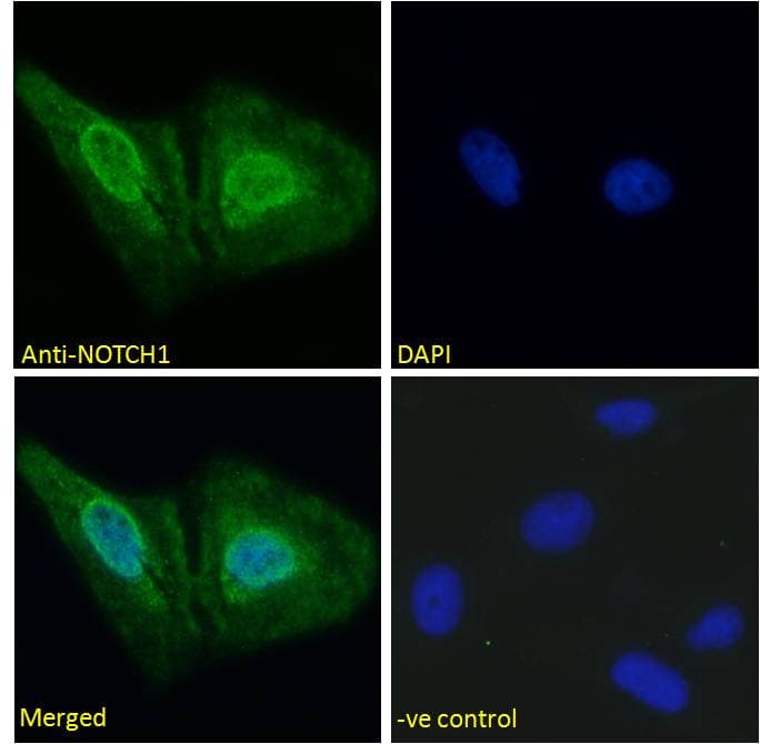 IHC-plus™ Polyclonal Goat anti-Human NOTCH1 Antibody (Amino Acids 171-182, IHC, IF)