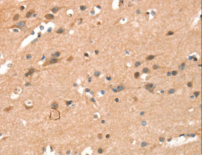 Polyclonal Rabbit anti-Human CRELD1 Antibody (IHC, WB)