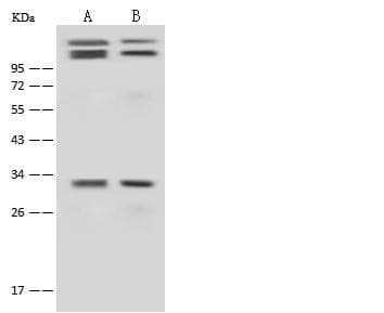 CCND3 / Cyclin D3 Antibody