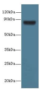 Polyclonal Rabbit anti-Human TSGA10 Antibody (IHC, WB)