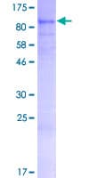 Human ARHGAP28 Protein (Recombinant GST)