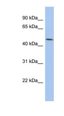 Polyclonal Rabbit anti-Human PTGER3 / EP3 Antibody (C-Terminus, WB)