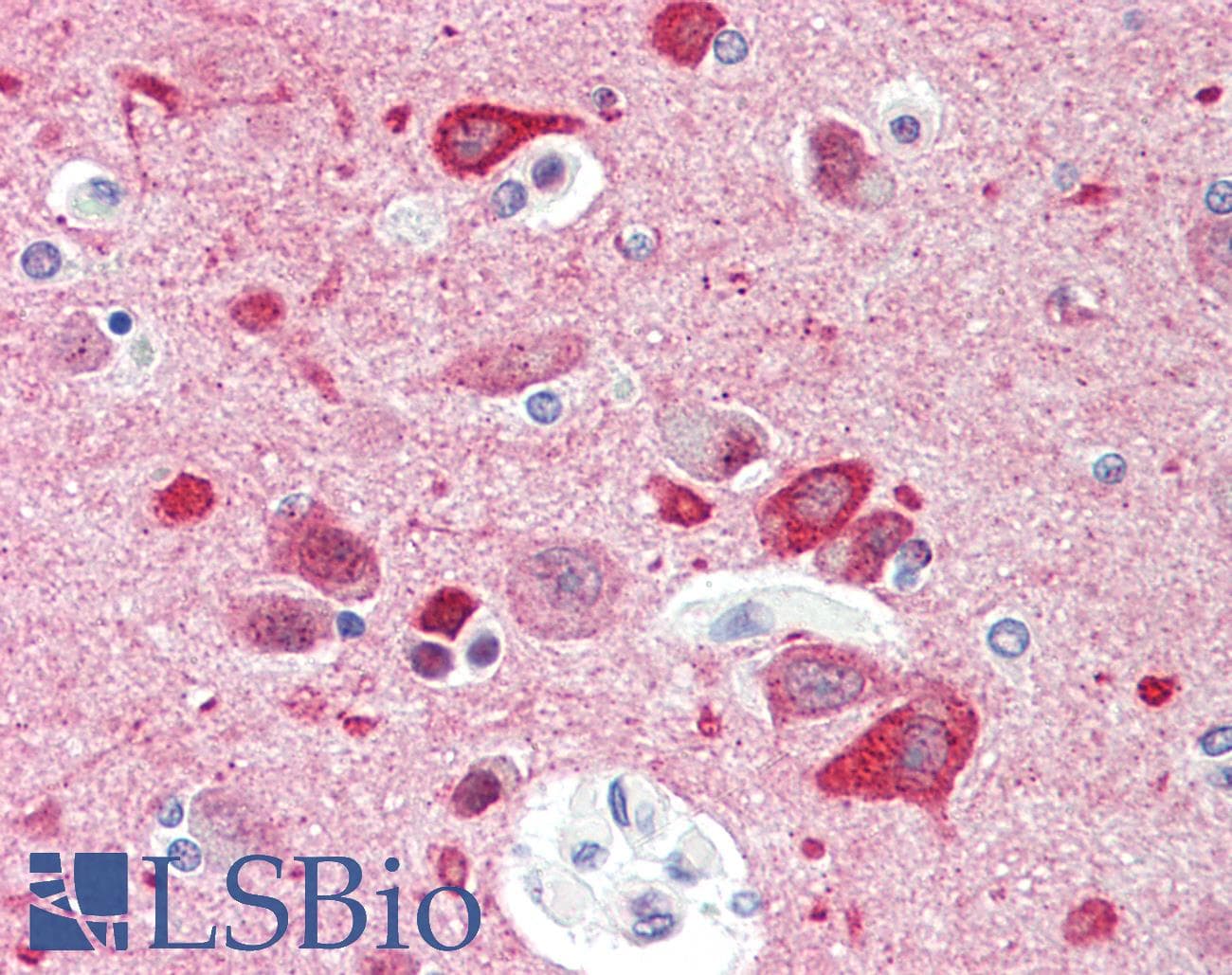 CCDC60 Antibody (aa470-519)