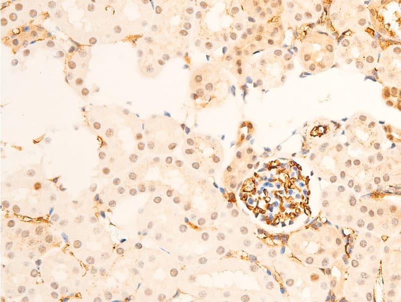Polyclonal Rabbit anti-Human TK1 / TK / Thymidine Kinase Antibody (phospho-Ser13, IHC, IF, WB)