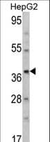 Polyclonal Rabbit anti-Human AMT Antibody (aa19-45, IHC, WB)