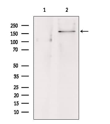 ABCC8 / SUR1 Antibody