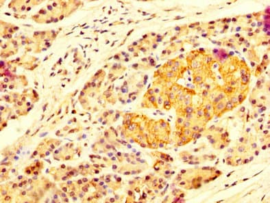 Polyclonal Rabbit anti-Human MAN2B2 Antibody (IHC)