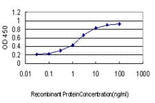 IHC-plus™ Monoclonal Mouse anti-Human UBCH10 / UBE2C Antibody (clone 9D3, IHC, IF, WB)
