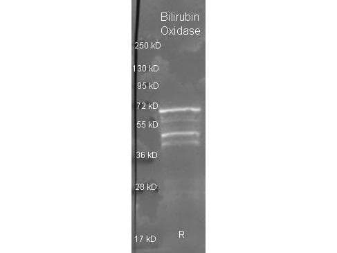 Bilirubin Oxidase Antibody