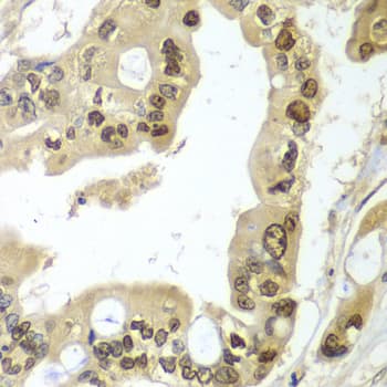 HR6B / UBE2B Antibody