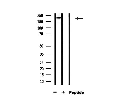 Polyclonal Rabbit anti-Human COL5A1 / Collagen V Alpha 1 Antibody (IHC, IF, WB)