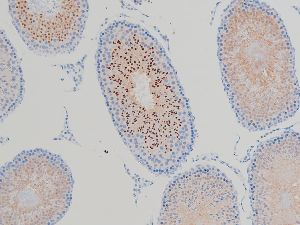 CFL1 / Cofilin Antibody (phospho-Ser3)