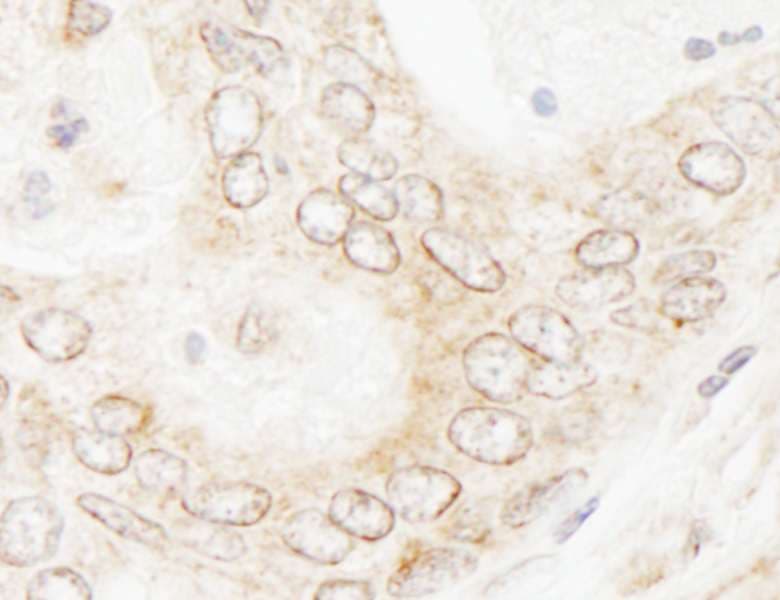 Polyclonal Rabbit anti-Human NUP35 / NUP53 Antibody (aa276-376, IHC, WB)