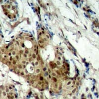 CDK11B / CDC2L1 Antibody (N-Terminus)