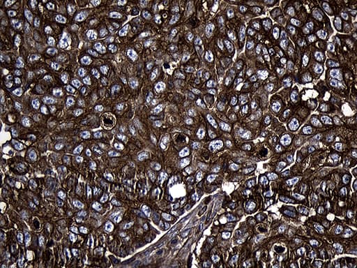 Monoclonal Mouse anti-Human MLC3F / MYL1 Antibody (clone OTI3D1, aa2-150, IHC, WB)