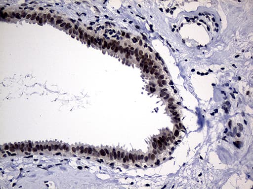 Monoclonal Mouse anti-Human HDAC9 Antibody (clone OTI2A7, aa181-460, IHC, WB)