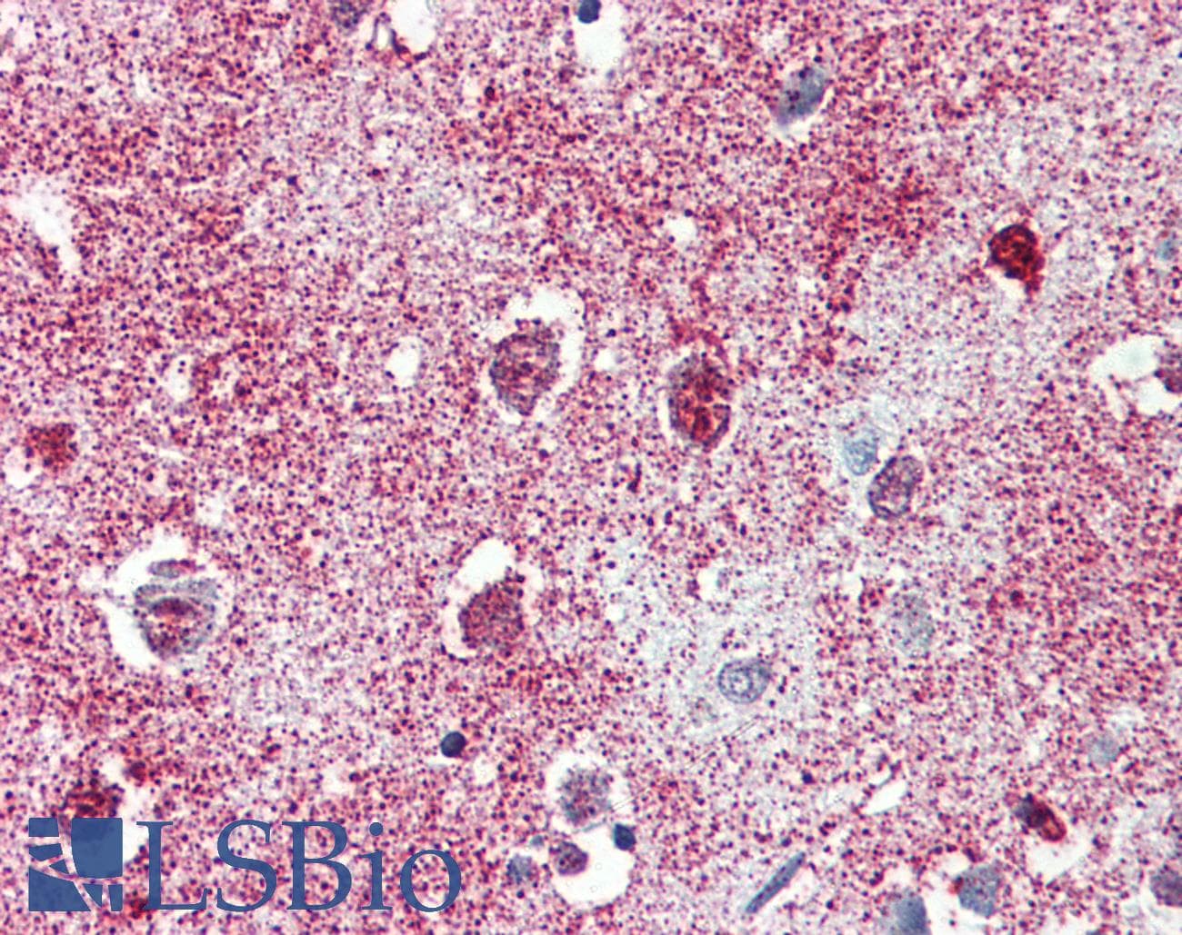 IHC-plus™ TAOK1 / TAO1 Antibody (C-Terminus)