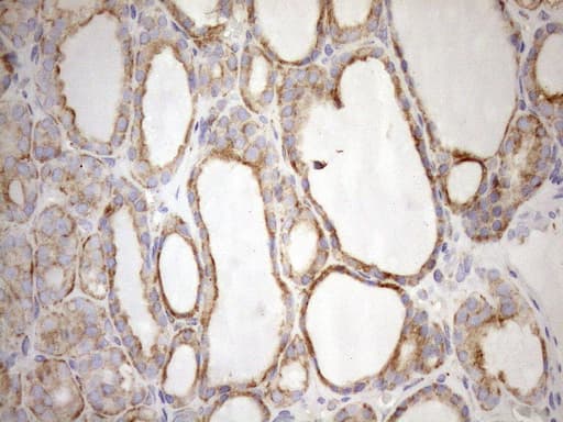 Monoclonal Mouse anti-Human NT5E / eNT / CD73 Antibody (clone OTI1G2, aa119-232, IHC, WB)