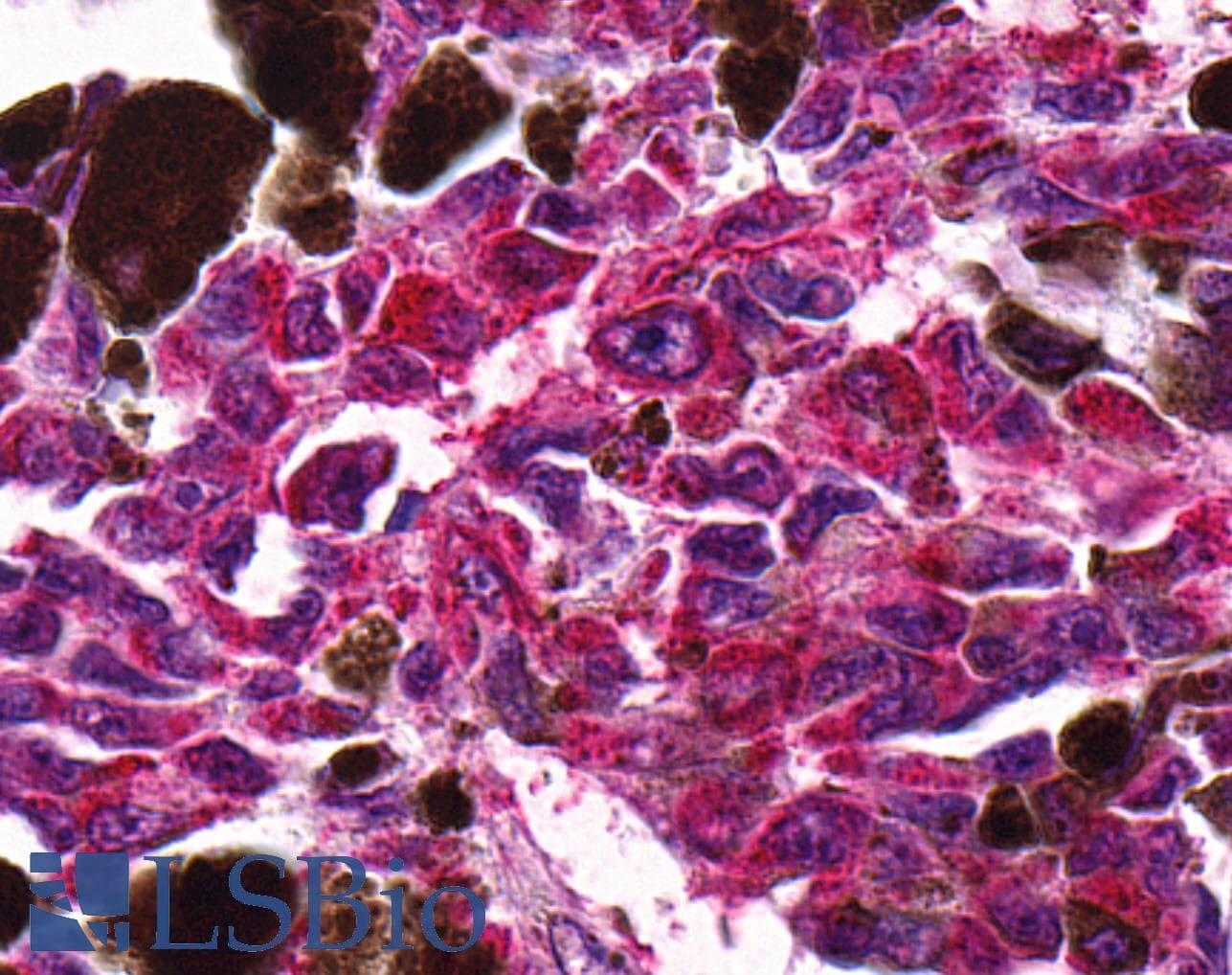 PathPlus™ Polyclonal Rabbit anti-Human NTSR2 / NTR2 Antibody (C-Terminus, IHC)
