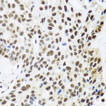 FUBP1 Antibody