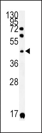 Polyclonal Rabbit anti-Human KIR2DS2 / CD158j Antibody (aa39-65, IHC, WB)