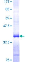 Human SPOCK3 Protein (Recombinant GST, N-terminus)