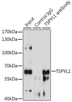 Polyclonal Rabbit anti-Human TSPYL1 Antibody (WB)