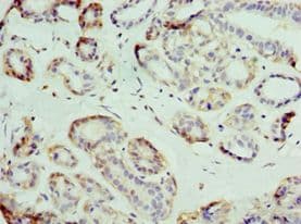 Polyclonal Rabbit anti-Human SLC39A6 / LIV-1 Antibody (aa170-320, IHC, WB)