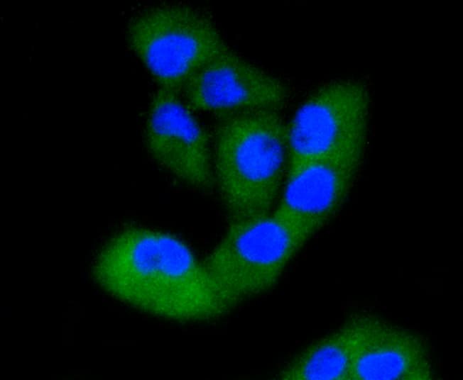 Monoclonal Rabbit anti-Human FAK / Focal Adhesion Kinase Antibody (IF, WB)