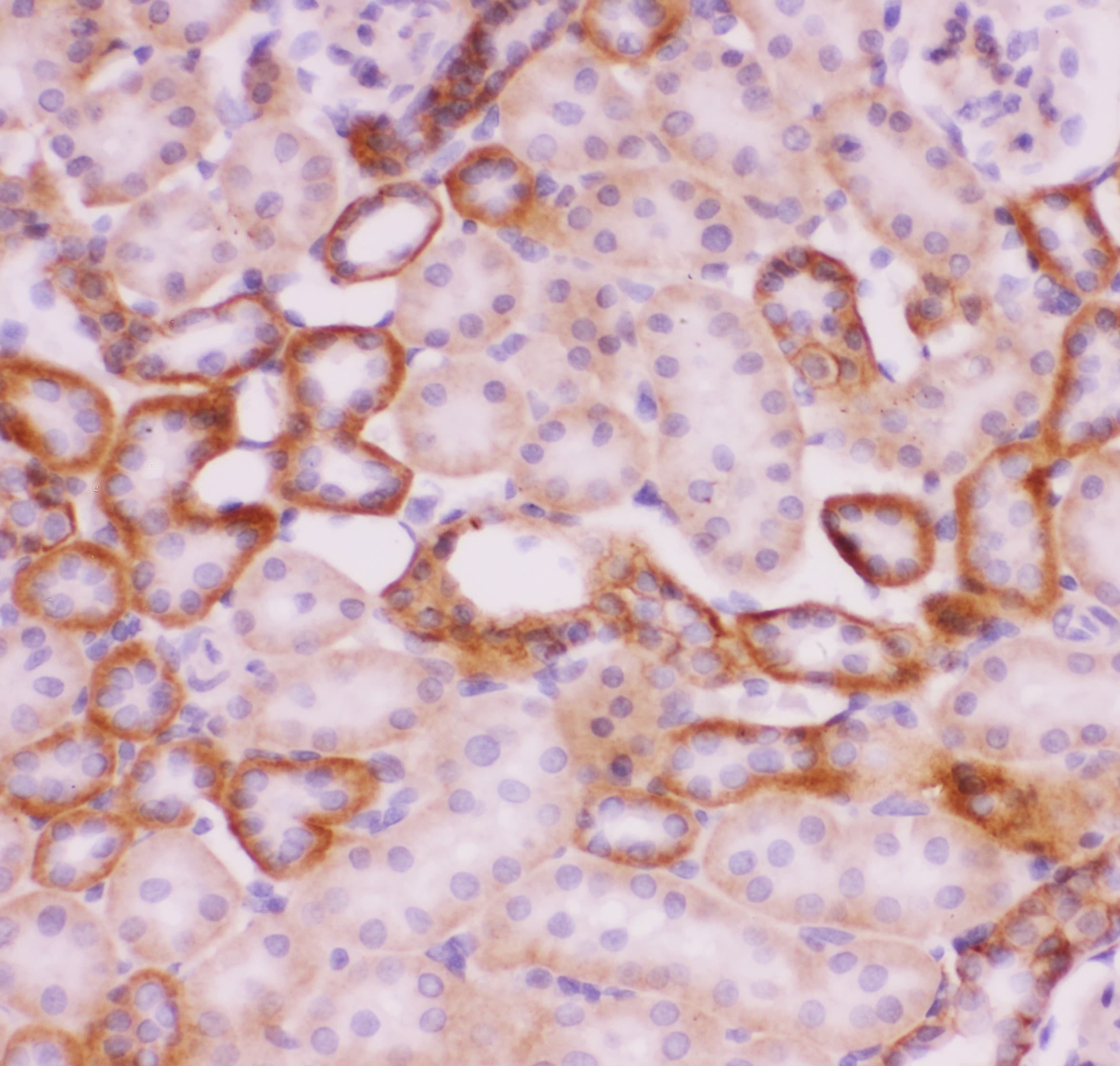 SLC9A1 / NHE1 Antibody (aa543-815)