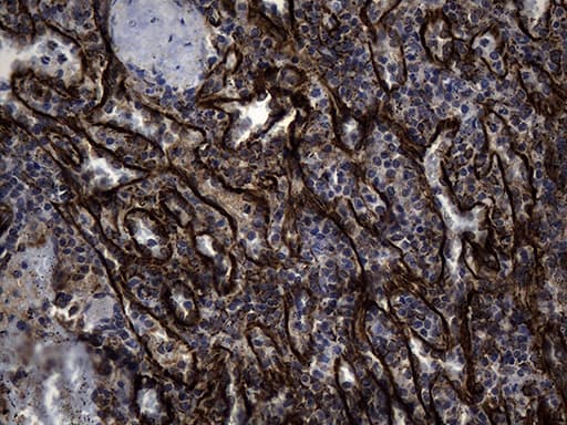 Monoclonal Mouse anti-Human NES / Nestin Antibody (clone OTI3B12, aa99-349, IHC, WB)