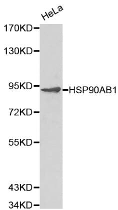 Polyclonal Rabbit anti-Human HSP90AB1 / HSP90 Alpha B1 Antibody (IHC, WB)