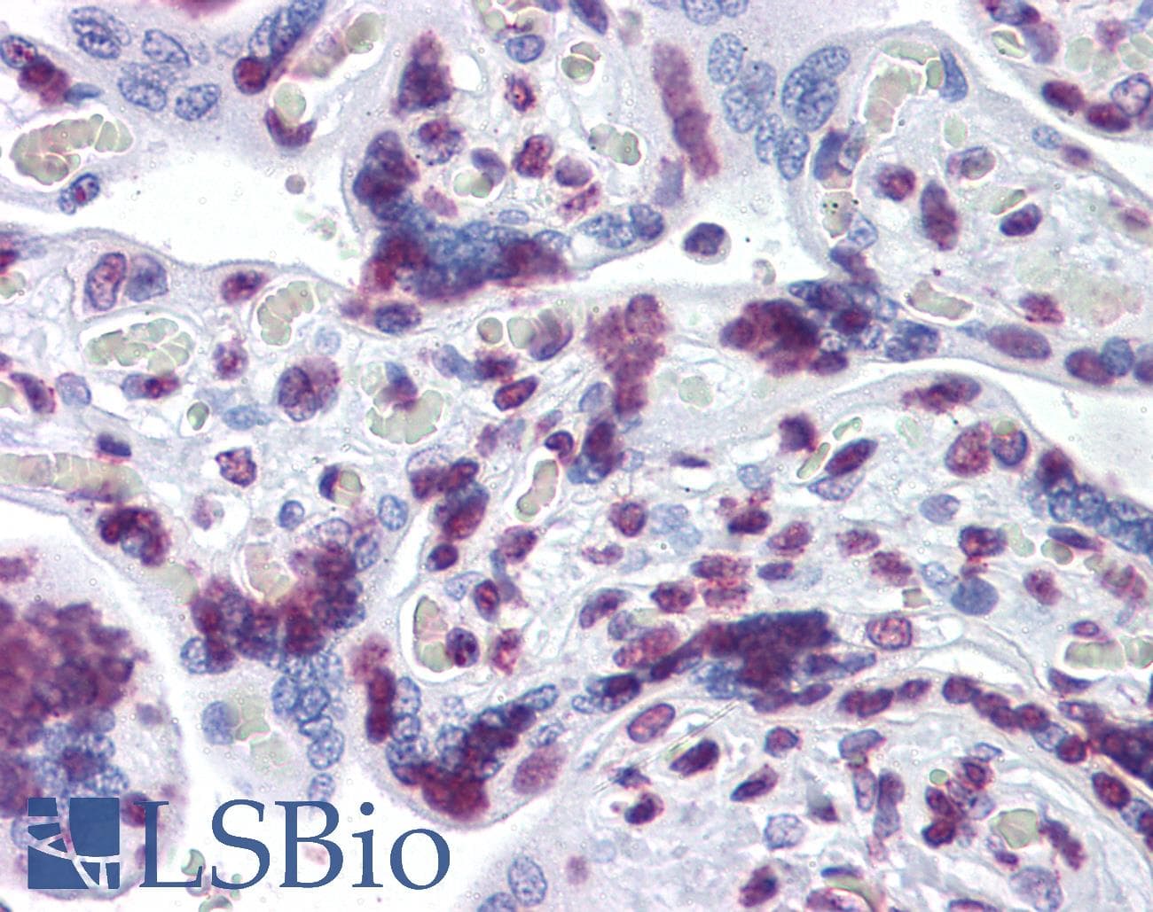 IHC-plus™ RBM5 / G15 Antibody (clone 2B6)