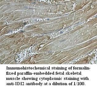 IDI2 Antibody (aa18-139)