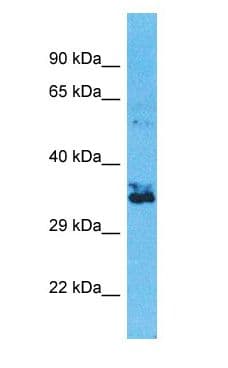 OR2W3 Antibody (C-Terminus)