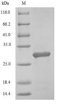 Mouse MAFK Protein (Recombinant 6His, N-terminus)