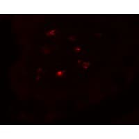 CTHRC1 Antibody