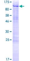 Human C14orf169 / NO66 Protein (Recombinant GST)