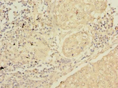 SFTPC / Surfactant Protein C Antibody
