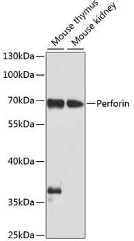 PRF1 / Perforin Antibody