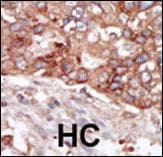 BLK Antibody (aa1-30)