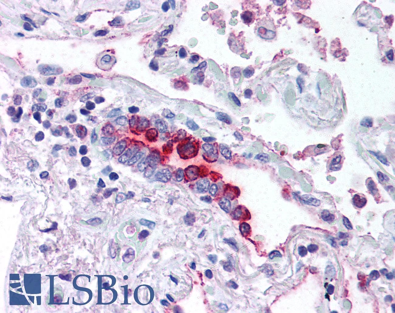 IHC-plus™ Polyclonal Rabbit anti-Mouse CTSE / Cathepsin E Antibody (C-Terminus, IHC, WB)