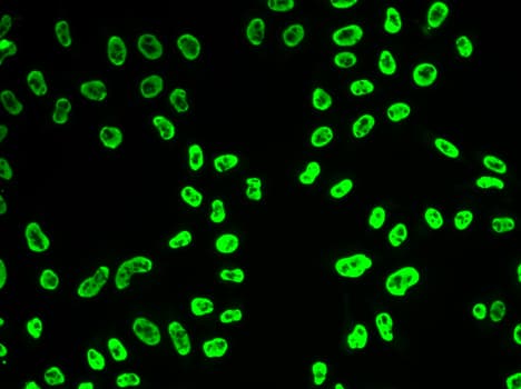 Polyclonal Rabbit anti-Human SNRPA / U1A Antibody (IHC, IF, WB)