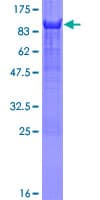 Human YAP / YAP1 Protein (Recombinant GST, N-terminus)