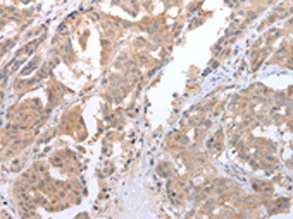 ATG16L1 / ATG16L Antibody