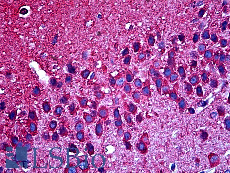 IHC-plus™ TUBB3 / Tubulin Beta 3 Antibody