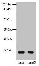 PDE6D / PDE6 Delta Antibody