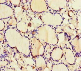 GK / Glycerol Kinase Antibody